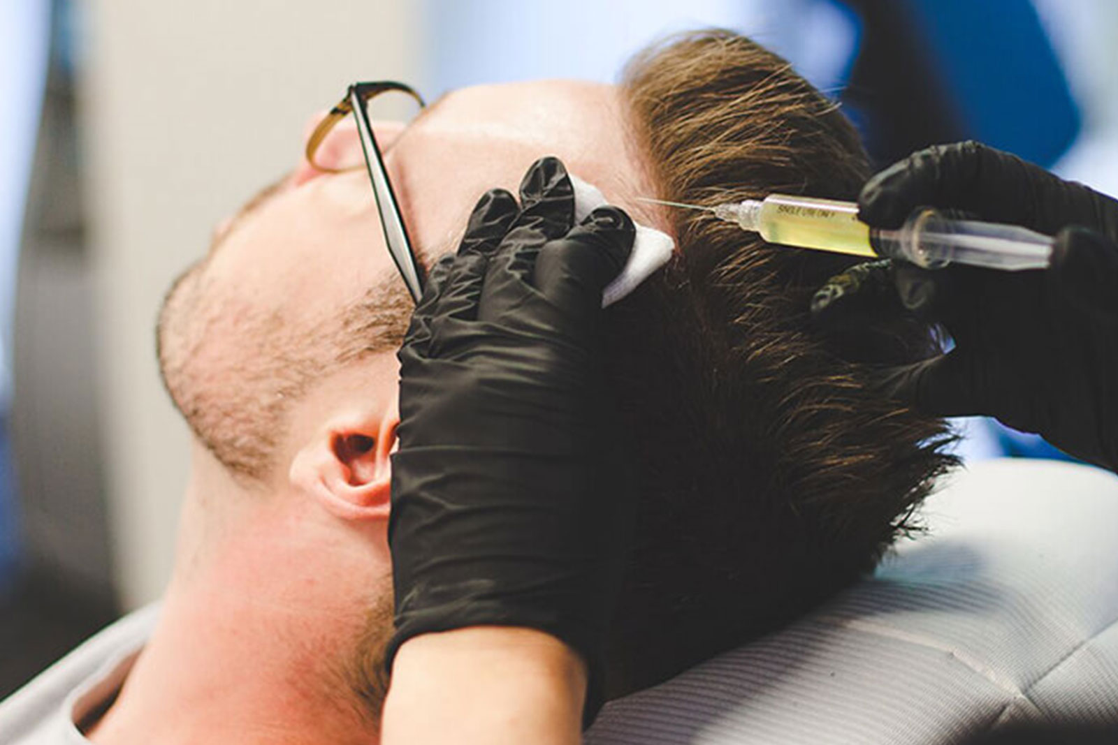 Revolutionizing Hair Loss Treatments - Sullivan Dermatology