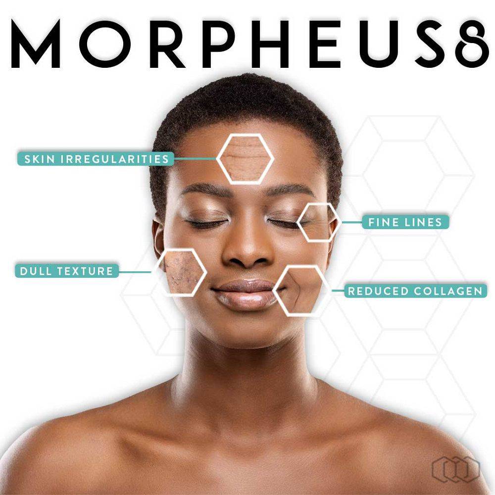 Morpheus8 - Reshaping the Landscape of Skin Rejuvenation