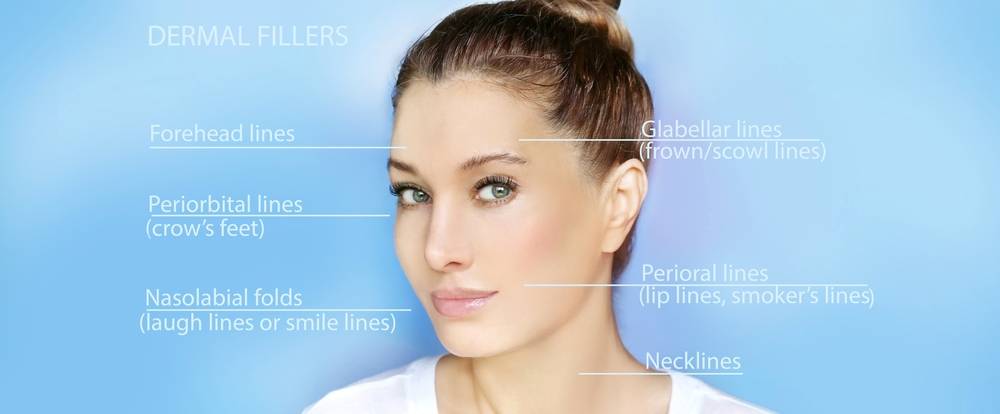 Complete Guide to Filler Injections